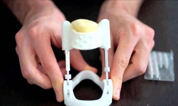 penis enlargement extender